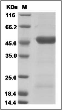 Canine IL11RA / IL-11RA / IL11R? Protein (His Tag) SDS-PAGE
