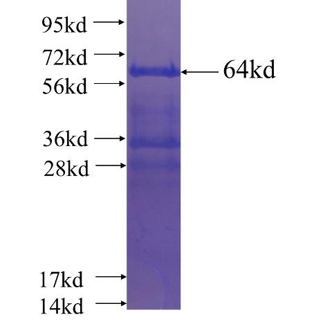 Recombinant human CENPC1 SDS-PAGE