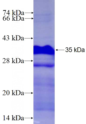 Recombinant Human ZNF256 SDS-PAGE