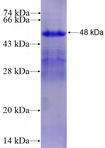 Recombinant Human EDN3 SDS-PAGE
