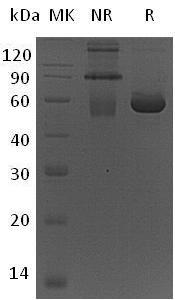 Human PEPD/PRD recombinant protein