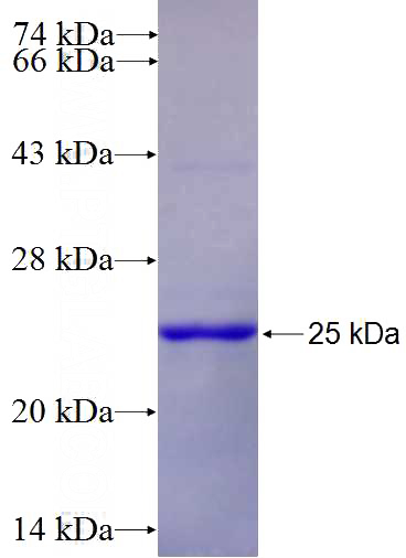 Recombinant Human KMT2D SDS-PAGE