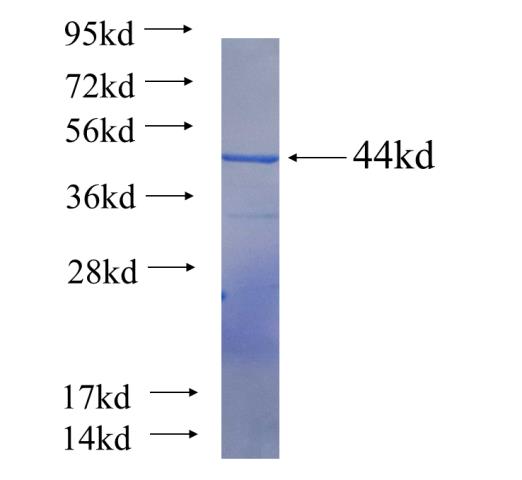 Recombinant human CKAP2L SDS-PAGE
