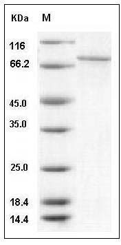 Human CAMK1G / CLICK III / CaMKIgamma Protein (His & GST Tag) SDS-PAGE