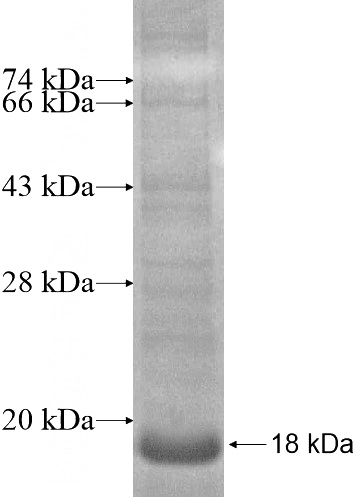 Recombinant Human SLC46A1 SDS-PAGE
