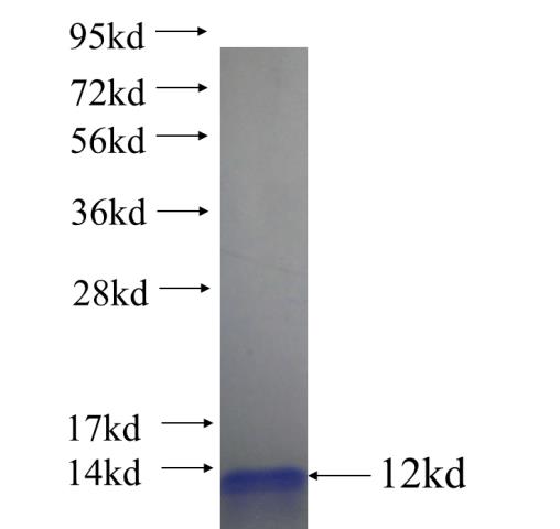 Recombinant human ZDHHC7 SDS-PAGE