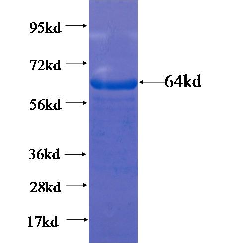 Recombinant human ANKS3 SDS-PAGE