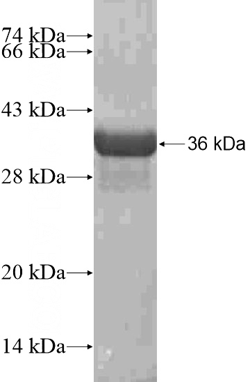 Recombinant Human CNGA2 SDS-PAGE