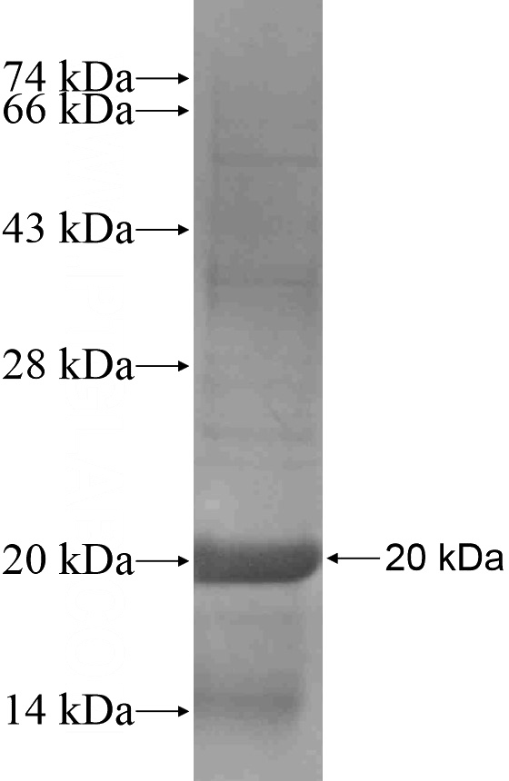 Recombinant Human COX5A SDS-PAGE