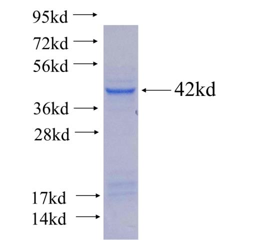 Recombinant human PAPSS2 SDS-PAGE