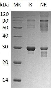 Human HPRT1/HPRT (His tag) recombinant protein