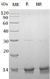 Human DYNLL1/DLC1/DNCL1/DNCLC1/HDLC1 (His tag) recombinant protein