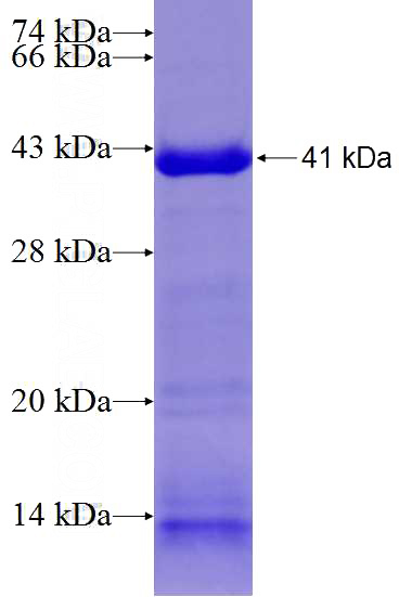 Recombinant Human TTC8 SDS-PAGE