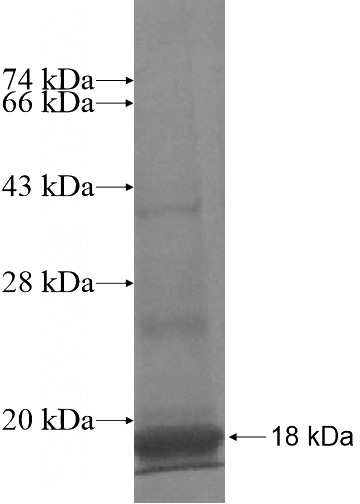 Recombinant Human CXCL17 SDS-PAGE