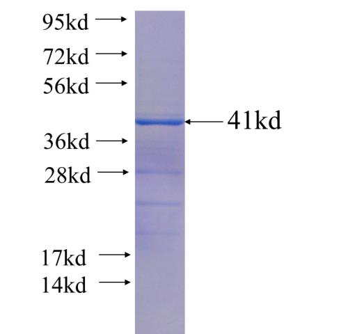 Recombinant human KLHDC4 SDS-PAGE