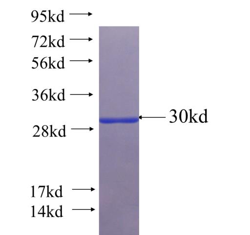 Recombinant Arabidopsis thaliana CAO SDS-PAGE
