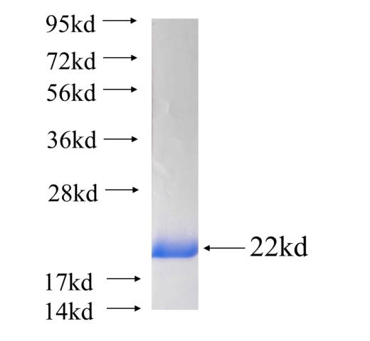 Recombinant human PPP1R14B(Full length) SDS-PAGE
