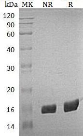 Human FKBP2/FKBP13 (His tag) recombinant protein