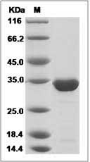 Mouse SBDS / Shwachman-Bodian-Diamond syndrome Protein (His Tag) SDS-PAGE