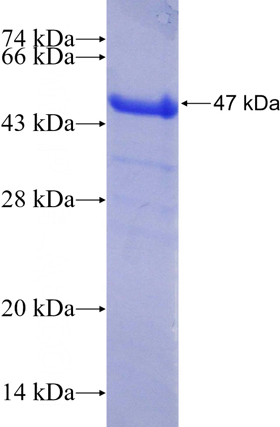Recombinant Human SLC9A9 SDS-PAGE