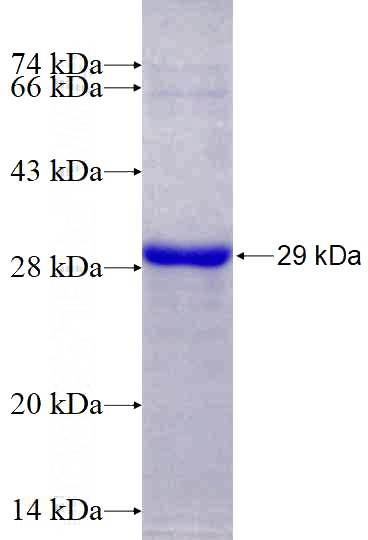 Recombinant Human SPON2 SDS-PAGE