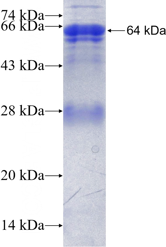 Recombinant Human EHD2 SDS-PAGE