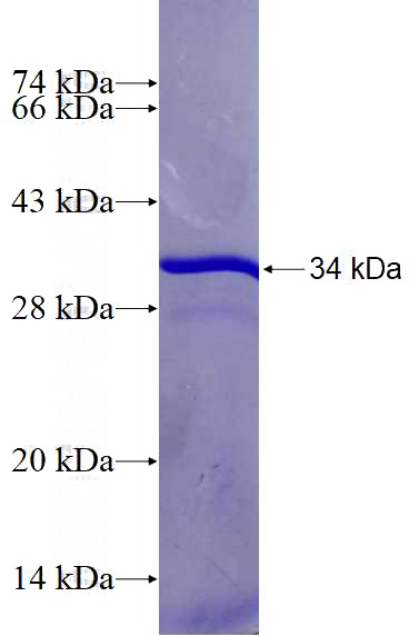 Recombinant Human ADIPOR1 SDS-PAGE