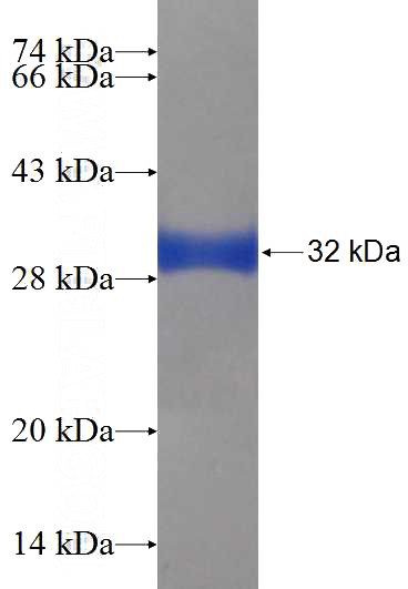 Recombinant Human SS18L2 SDS-PAGE