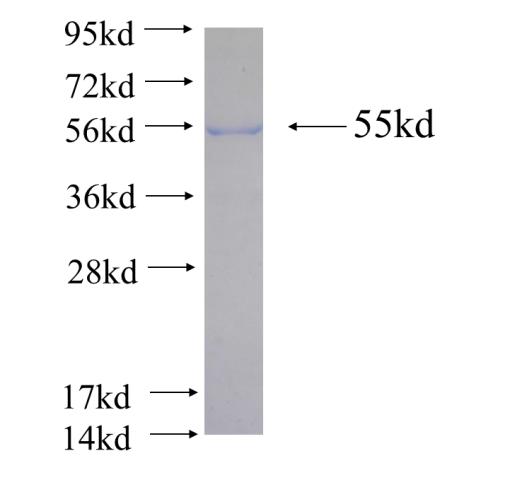 Recombinant human CTAGE6 SDS-PAGE