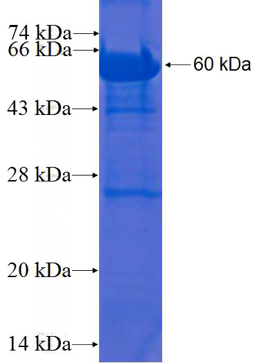 Recombinant Human BLVRA SDS-PAGE