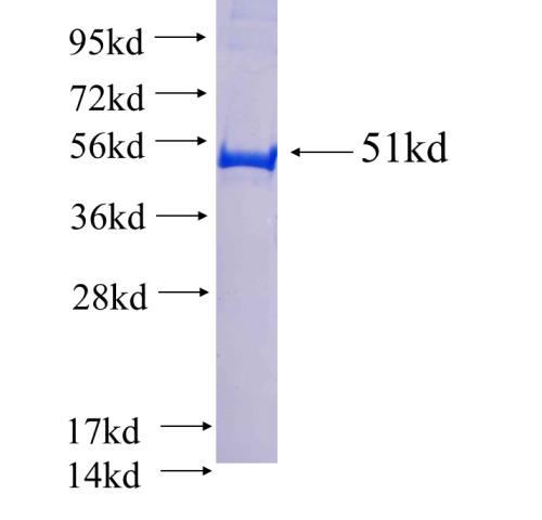 Recombinant human XPR1 SDS-PAGE