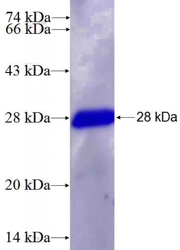 Recombinant Human RHOB SDS-PAGE