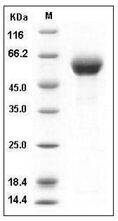 Human DDR1 Kinase / MCK10 / CD167 Protein (His Tag) SDS-PAGE