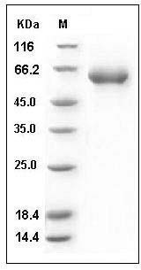 Human CD122 / IL-2RB Protein (Fc Tag) SDS-PAGE