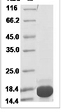 Human IL21/IL-21 Protein 14105