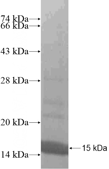 Recombinant Human FSCN2 SDS-PAGE