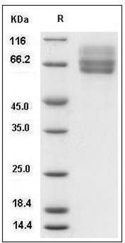Mouse Coagulation Factor IX / FIX / F9 Protein (His Tag) SDS-PAGE