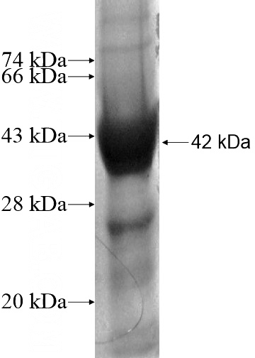 Recombinant Human NOL11 SDS-PAGE