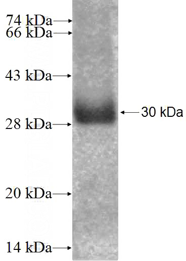 Recombinant Human RGS17 SDS-PAGE