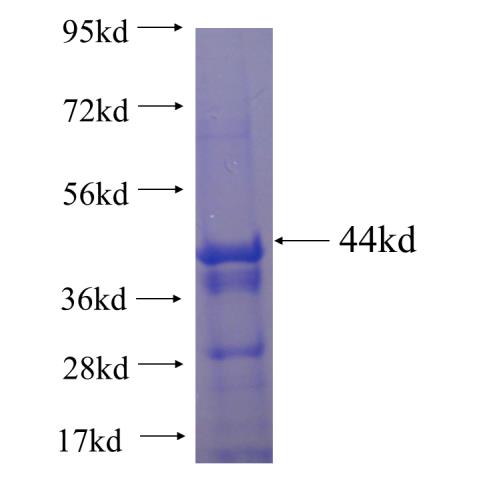 Recombinant human SRPX SDS-PAGE