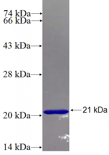 Recombinant Human IFT20 SDS-PAGE