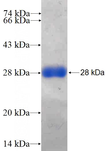 Recombinant Human MUL1 SDS-PAGE