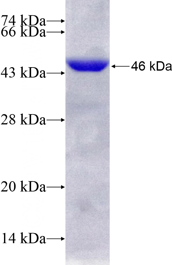 Recombinant Human HIBCH SDS-PAGE