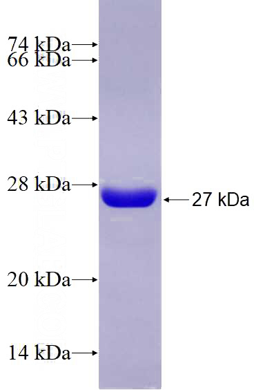 Recombinant Human GP5 SDS-PAGE