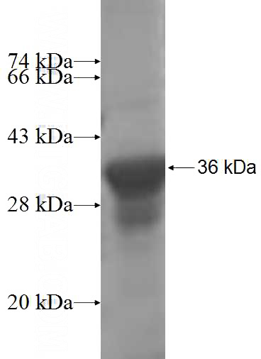 Recombinant Human TRMT1 SDS-PAGE