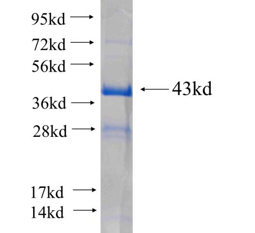 Recombinant human NGB(Full length) SDS-PAGE