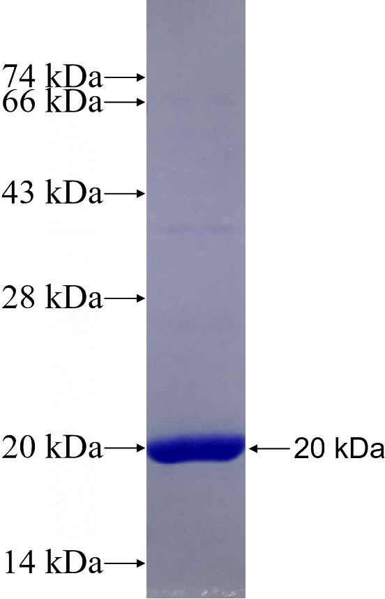 Recombinant Human PTPLAD1 SDS-PAGE