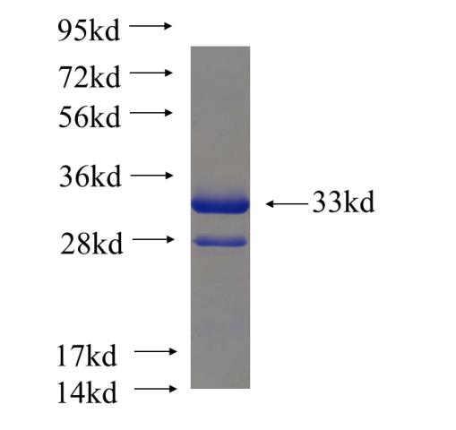 Recombinant human HOPX SDS-PAGE