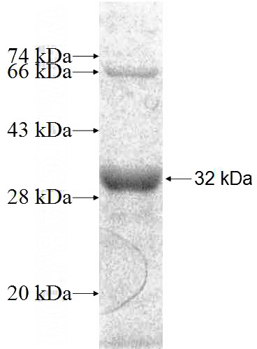Recombinant Human C1QL1 SDS-PAGE
