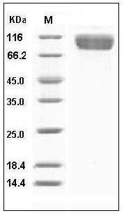 Human IL1RL1 / DER4 Protein (Fc Tag) SDS-PAGE